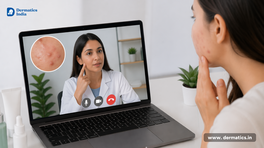 Online Dermatologist Consultation for Acne: Expert Skin Help from Home