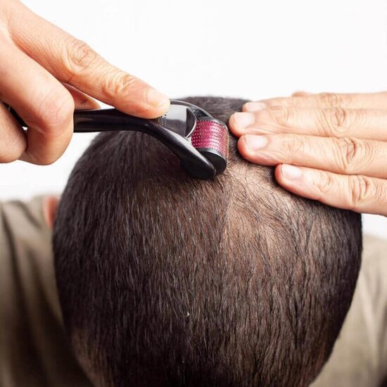 Derma Roller System 540 Needles [0.50mm]