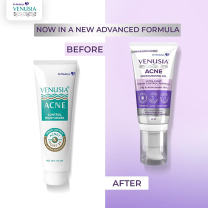 Venusia Acne Moisturizig Gel with Ultra Light Sebum Control Formula, 60gm