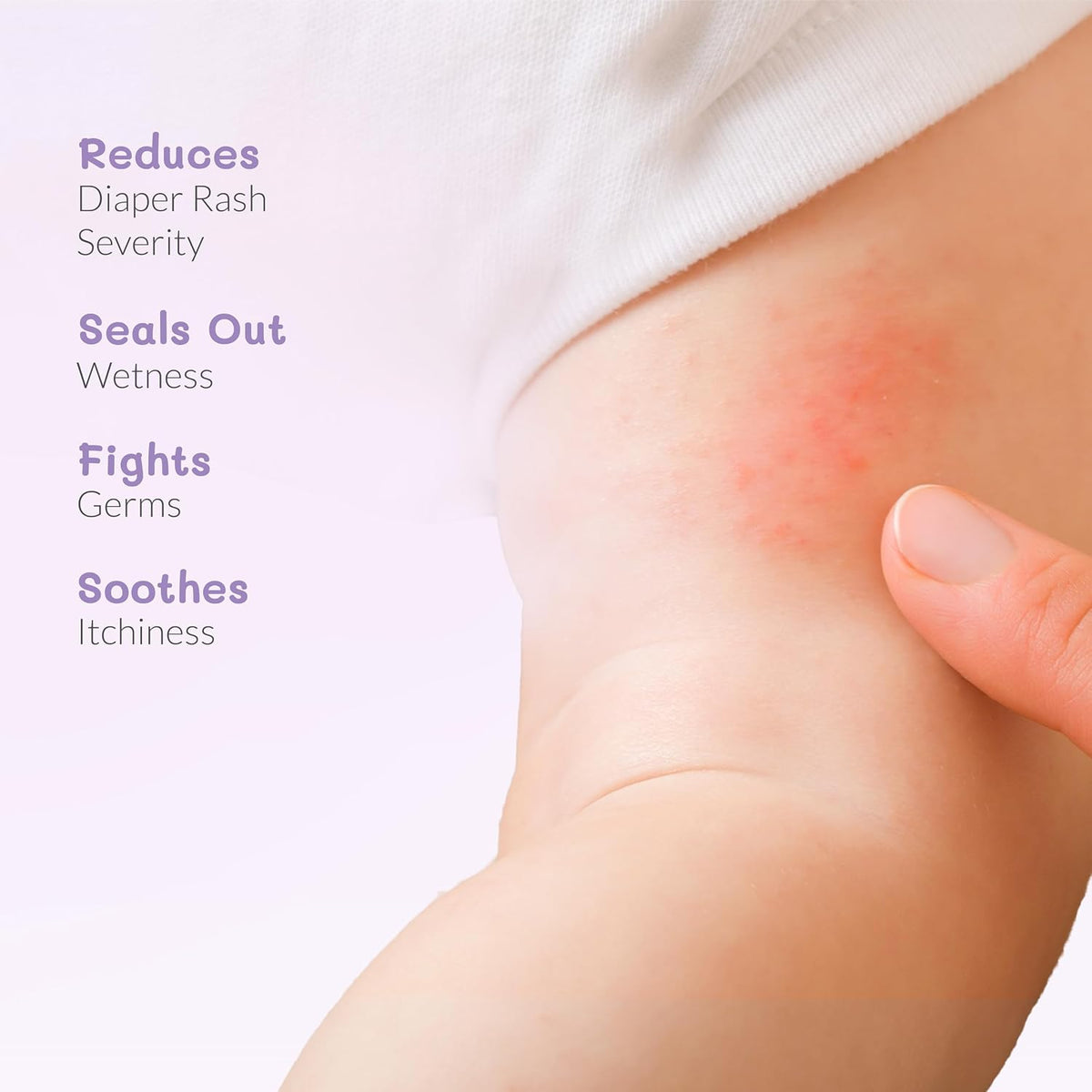 AreoVeda Diaper Rash Cream 50gm