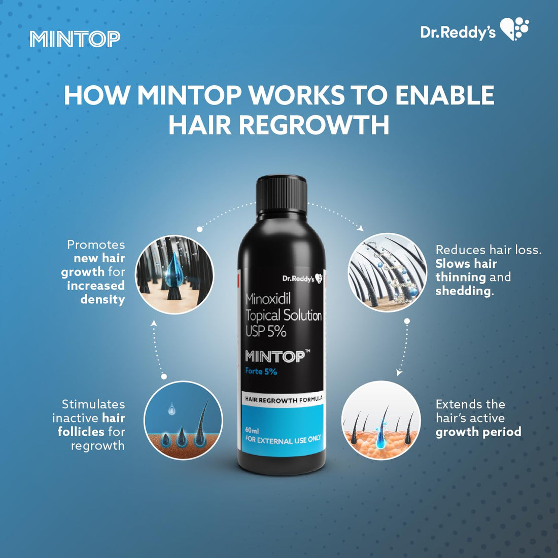 Mintop Forte 5% Hair Solution 60ml