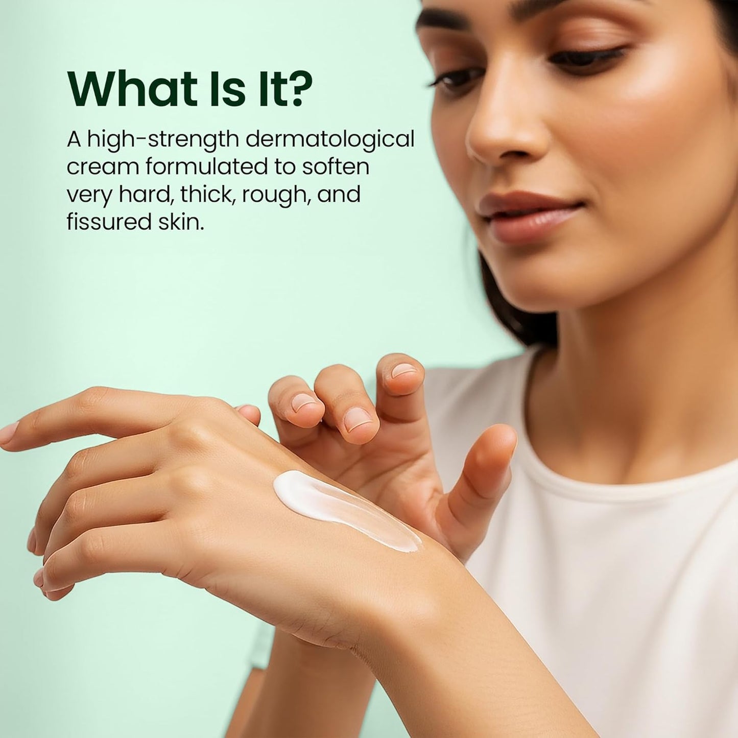 NMFe Urea 40% Cream Gel For Extremely Dry Skin & Nails,, 50gm