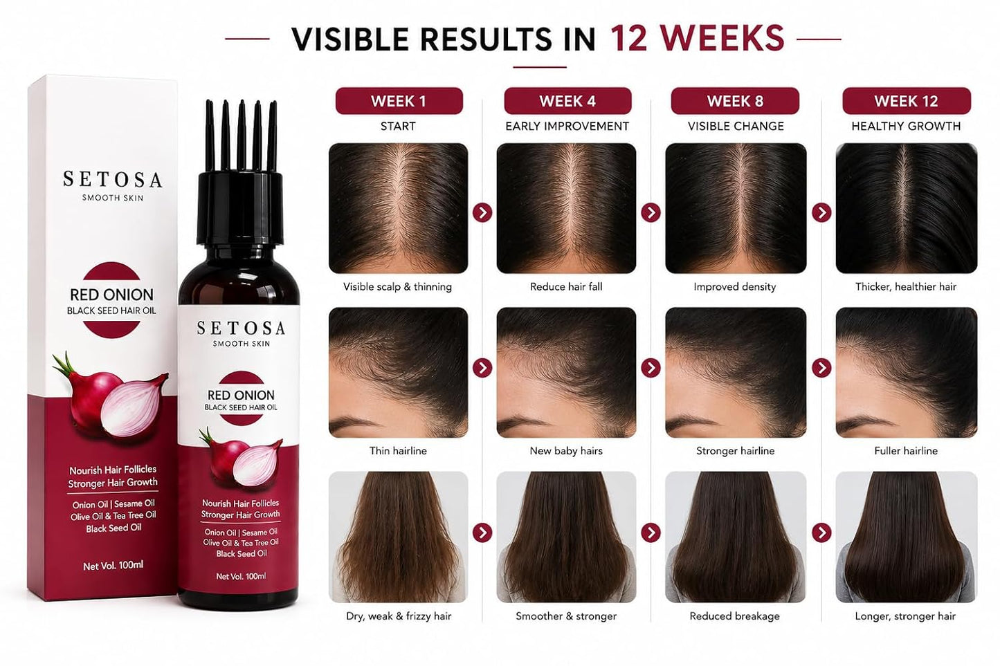 Setosa Smooth Skin Red Onion Black Seed Hair Oil 100ml