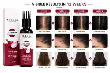 Setosa Smooth Skin Red Onion Black Seed Hair Oil 100ml