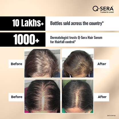 Q Sera Hair Serum, 60ml