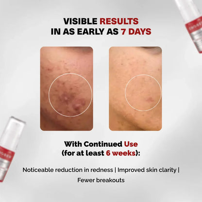 Chosen Red covery Serum 20ml