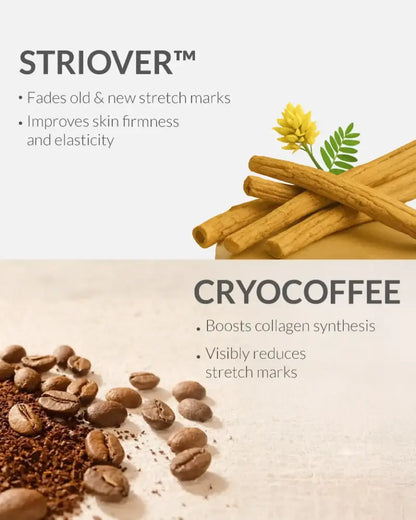 AreoVeda Stretch Marks Cream 50gm