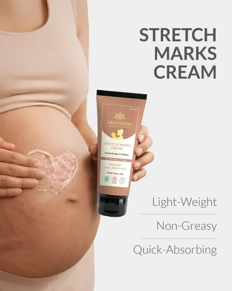 AreoVeda Stretch Marks Cream 50gm