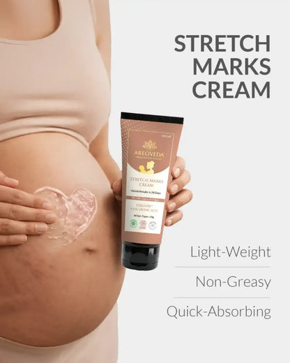 AreoVeda Stretch Marks Cream 50gm