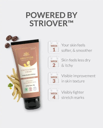 AreoVeda Stretch Marks Cream 50gm