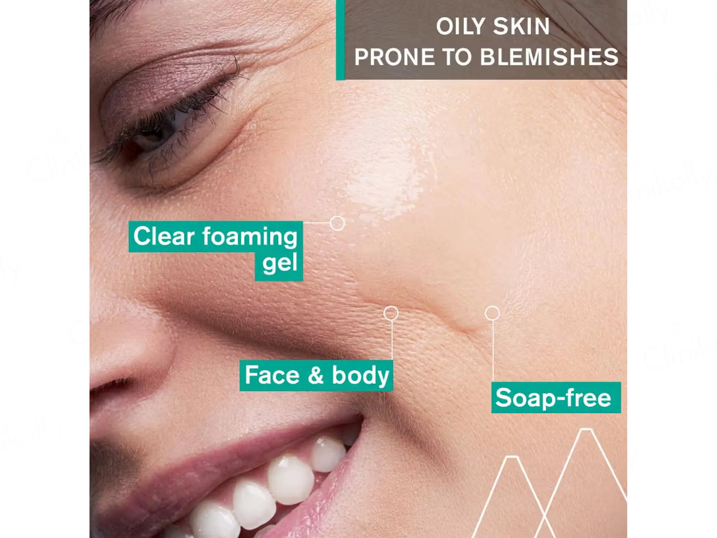 Uriage Hyseac Anti-Blemish Cleansing Gel 150ml