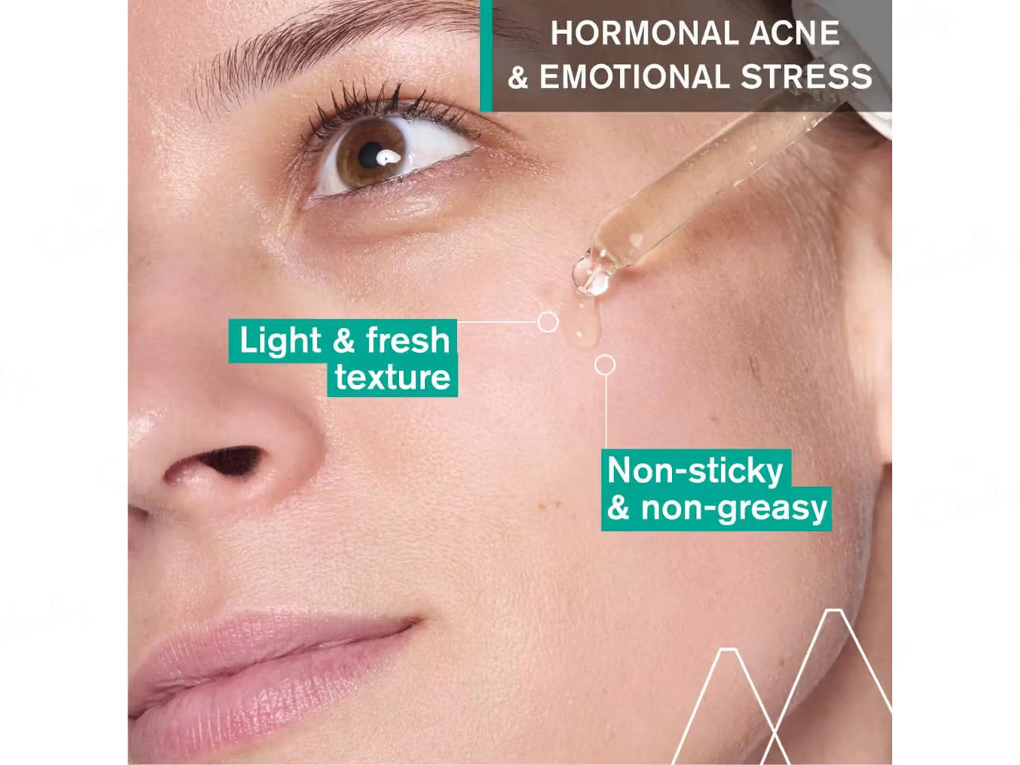 Uriage Hyseac New Skin Anti-Blemish Booster Serum 30ml